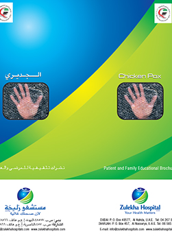 https://demo.zulekhahospitals.com/uploads/leaflets_cover/16What-is-chickenpox.jpg