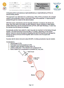 https://demo.zulekhahospitals.com/uploads/leaflets_cover/32PCNL.jpg