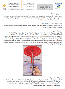 https://demo.zulekhahospitals.com/uploads/leaflets_cover/32TURBT-arabic.jpg